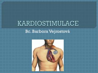 kardiostimulace