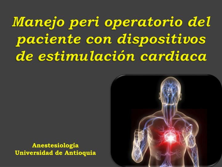 manejo peri operatorio del paciente con dispositivos de estimulaci n cardiaca