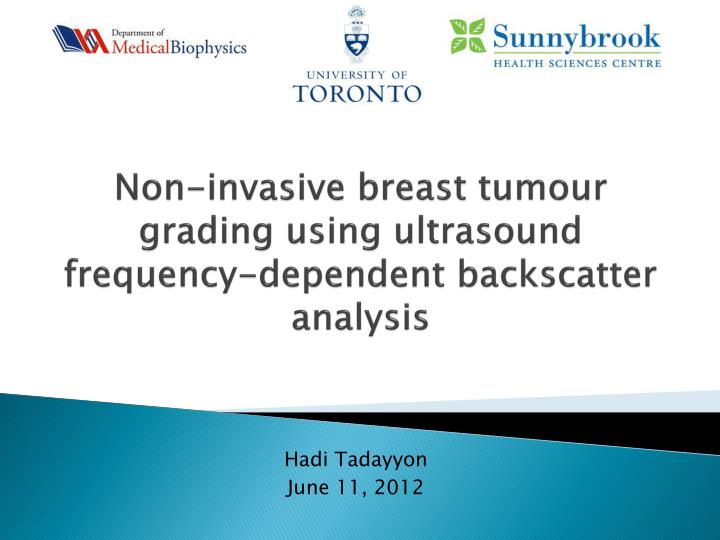non invasive breast tumour grading using ultrasound frequency dependent backscatter analysis