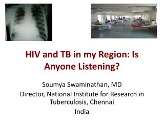 HIV and TB in my Region: Is Anyone Listening?