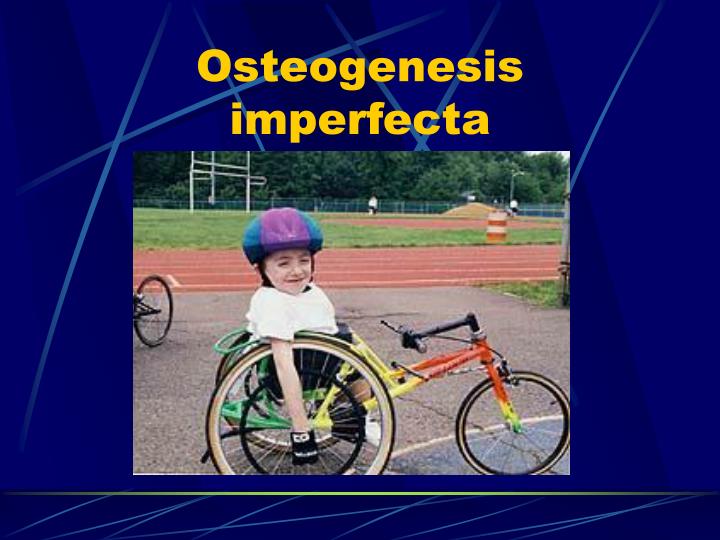 osteogenesis imperfecta