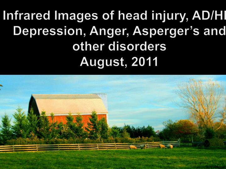 infrared images of head injury ad hd depression anger asperger s and other disorders august 2011