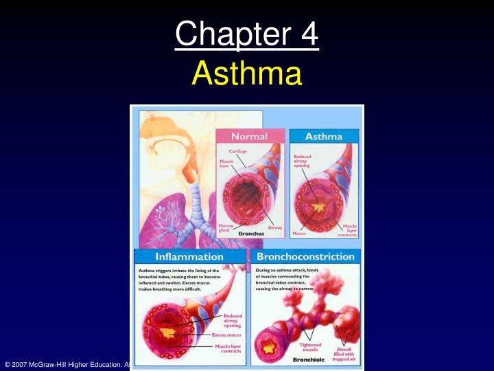 chapter 4 asthma