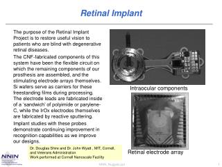 Retinal Implant