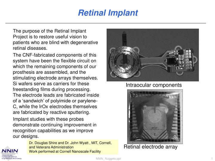 retinal implant