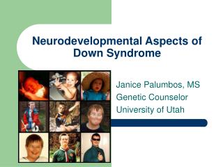 Neurodevelopmental Aspects of Down Syndrome