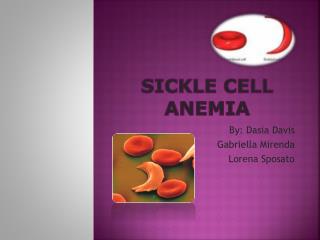 sickle cell anemia