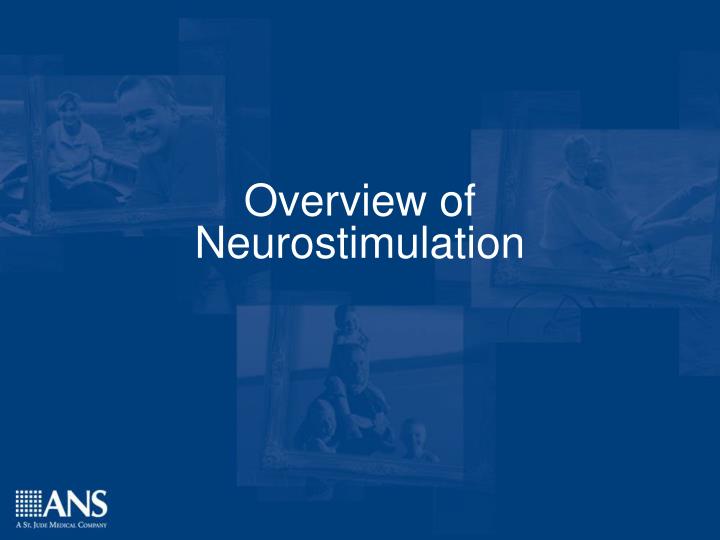 overview of neurostimulation