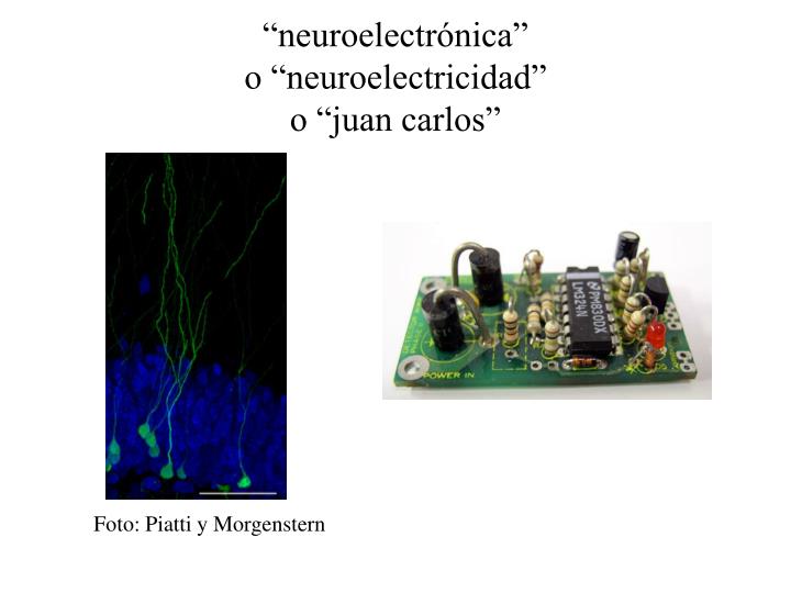 neuroelectr nica o neuroelectricidad o juan carlos