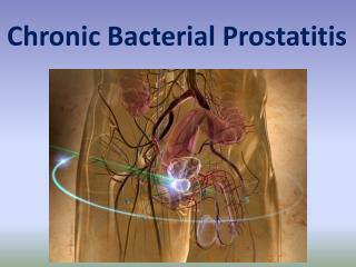 Chronic Bacterial Prostatitis (CBP)