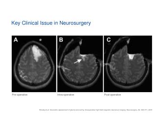 Key Clinical Issue in Neurosurgery