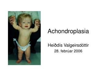 achondroplasia