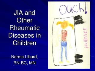 JIA and Other Rheumatic Diseases in Children