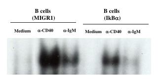 B cells (MIGR1)