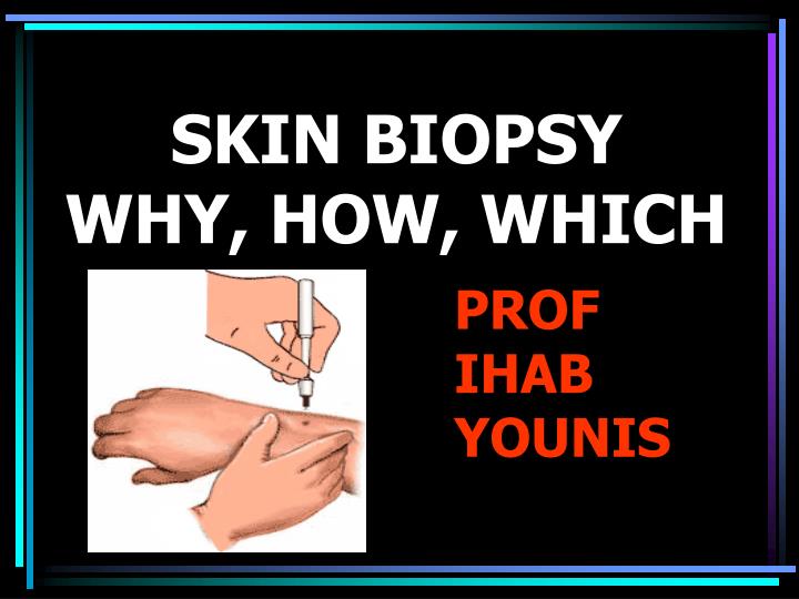 skin biopsy why how which
