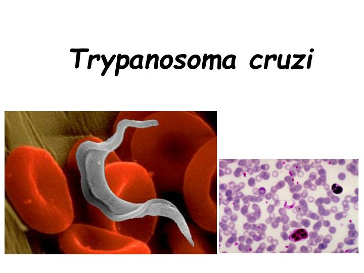 trypanosoma cruzi