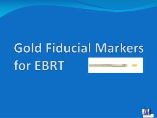 Gold Fiducial Markers for EBRT