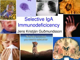 selective iga immunodeficicency