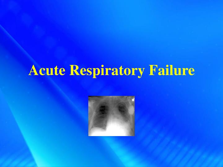 acute respiratory failure