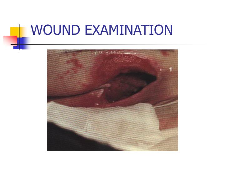 wound examination
