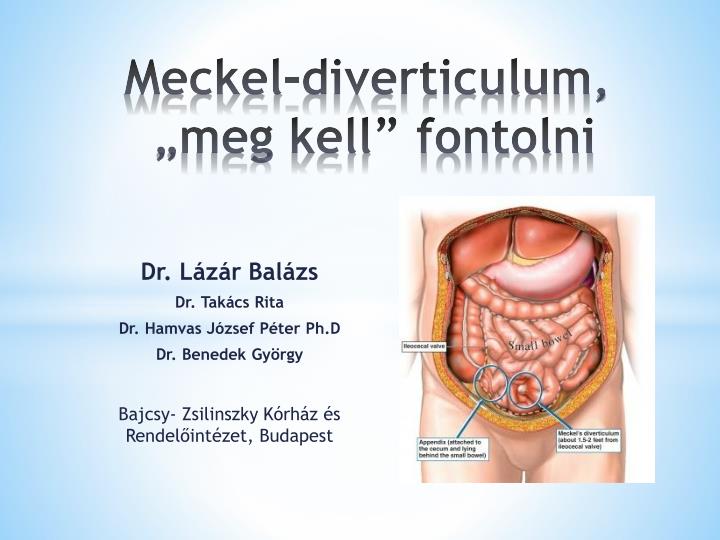 meckel diverticulum meg kell fontolni