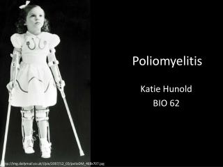 Poliomyelitis