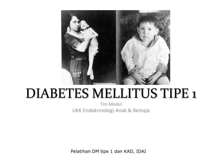 diabetes mellitus t i pe 1