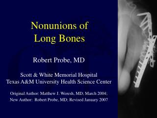 Nonunions of Long Bones
