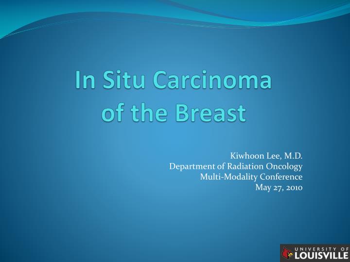 in situ carcinoma of the breast