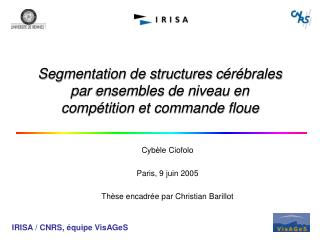 segmentation de structures c r brales par ensembles de niveau en comp tition et commande floue