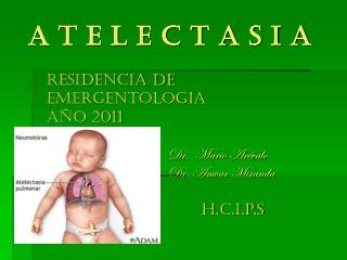 a t e l e c t a s i a