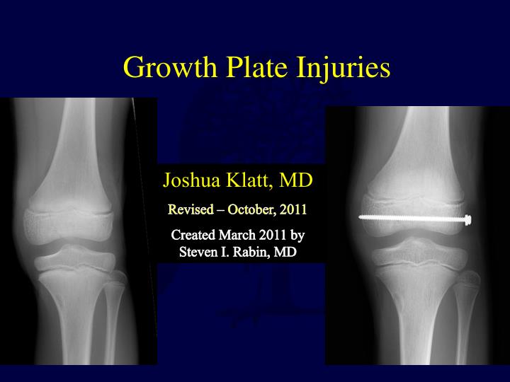 growth plate injuries