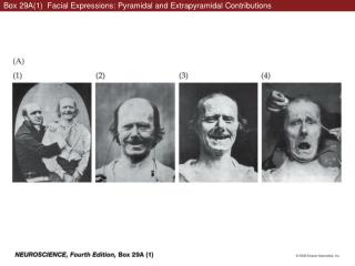 Box 29A(1) Facial Expressions: Pyramidal and Extrapyramidal Contributions