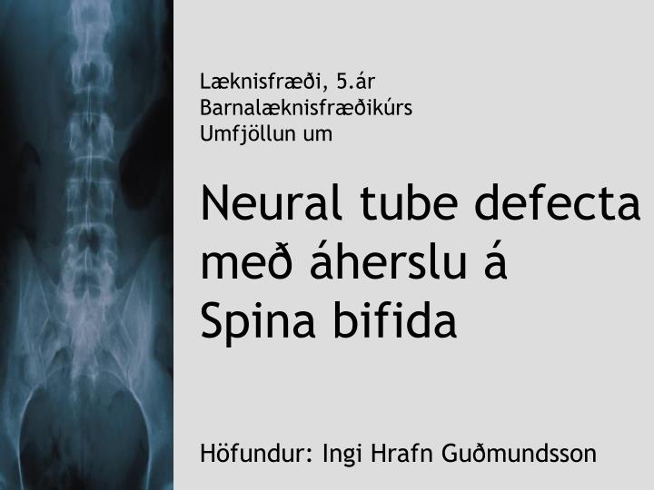 l knisfr i 5 r barnal knisfr ik rs umfj llun um neural tube defecta me herslu spina bifida