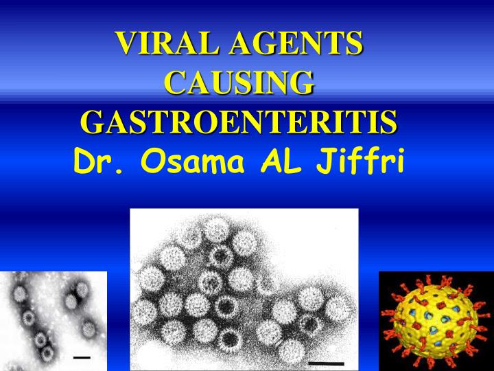 viral agents causing gastroenteritis dr osama al jiffri