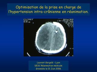 optimisation de la prise en charge de l hypertension intra cr nienne en r animation