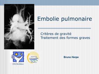 embolie pulmonaire