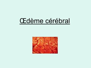 d me c r bral