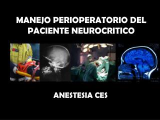 manejo perioperatorio del paciente neurocritico