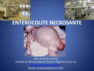 enterocolite necrosante