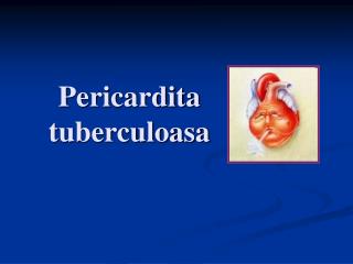 Pericardita tuberculoasa