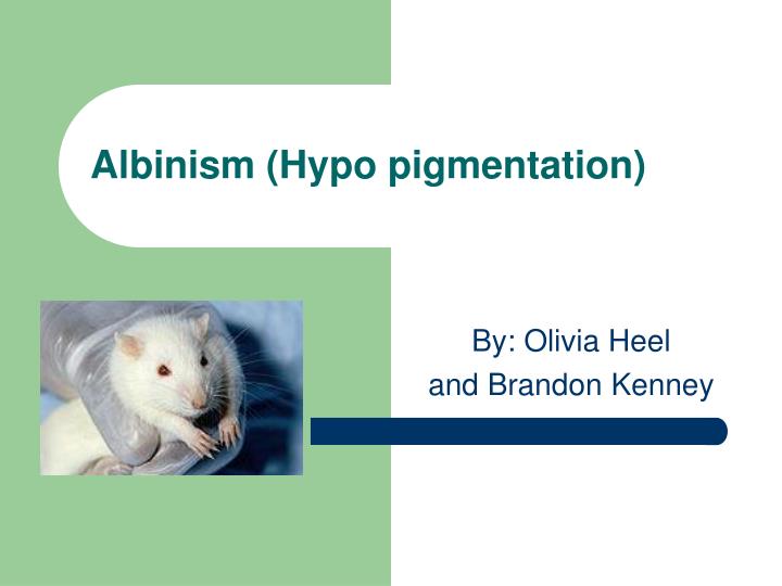 albinism hypo pigmentation
