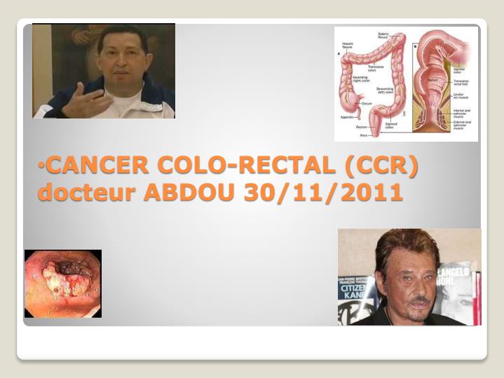 cancer colo rectal ccr docteur abdou 30 11 2011