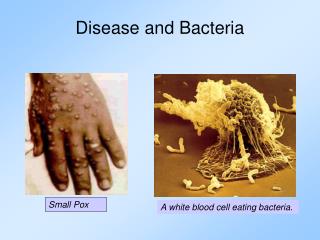 Disease and Bacteria