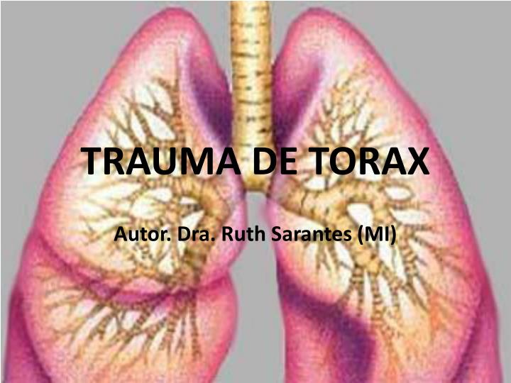 trauma de torax