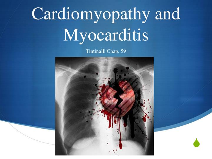 cardiomyopathy and myocarditis
