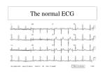 The normal ECG - slide 1
