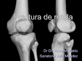fractura de rotula