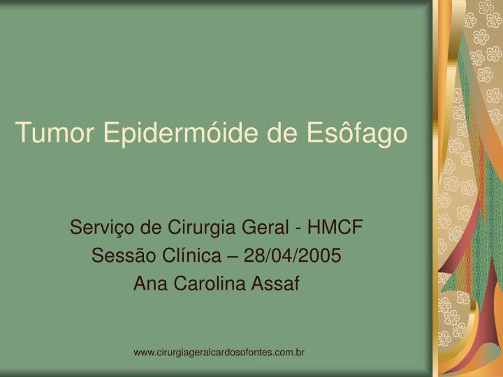 tumor epiderm ide de es fago