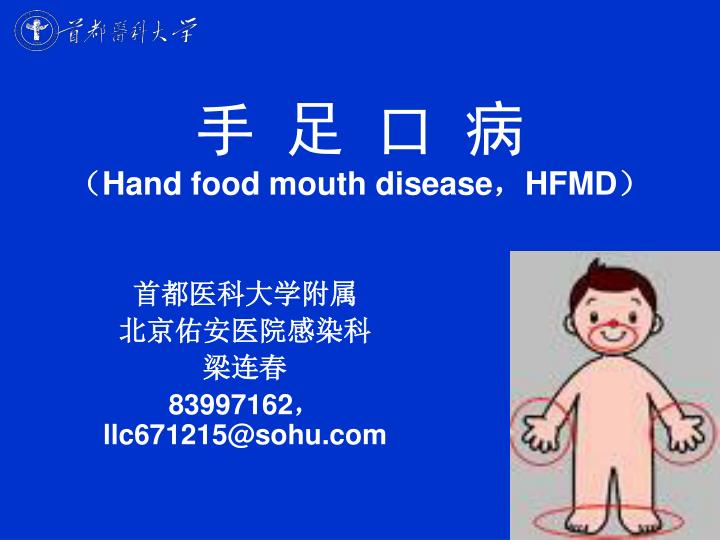 hand food mouth disease hfmd